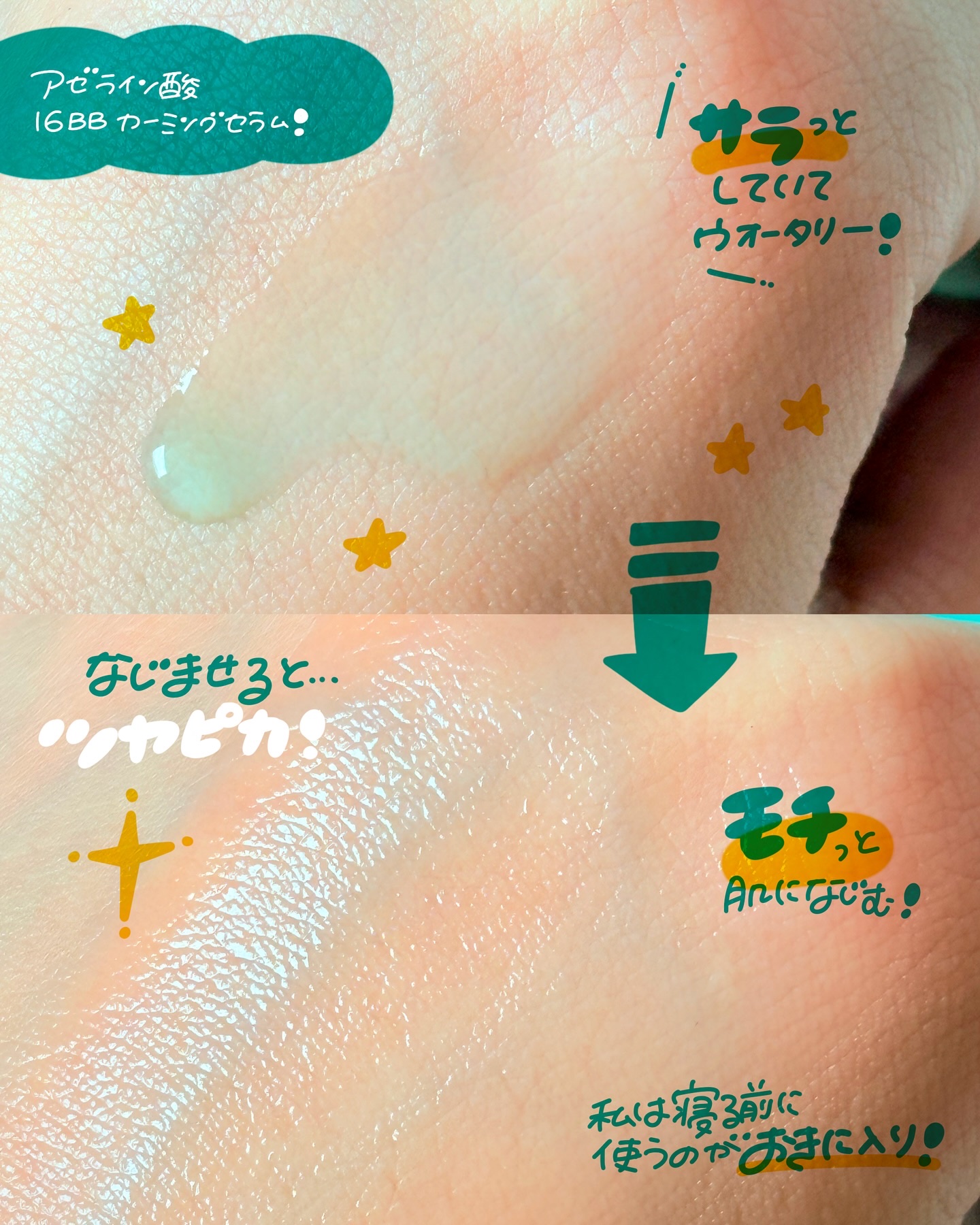 アゼライン酸16BBスージングセラム/MEDICUBE/美容液を使ったクチコミ（3枚目）