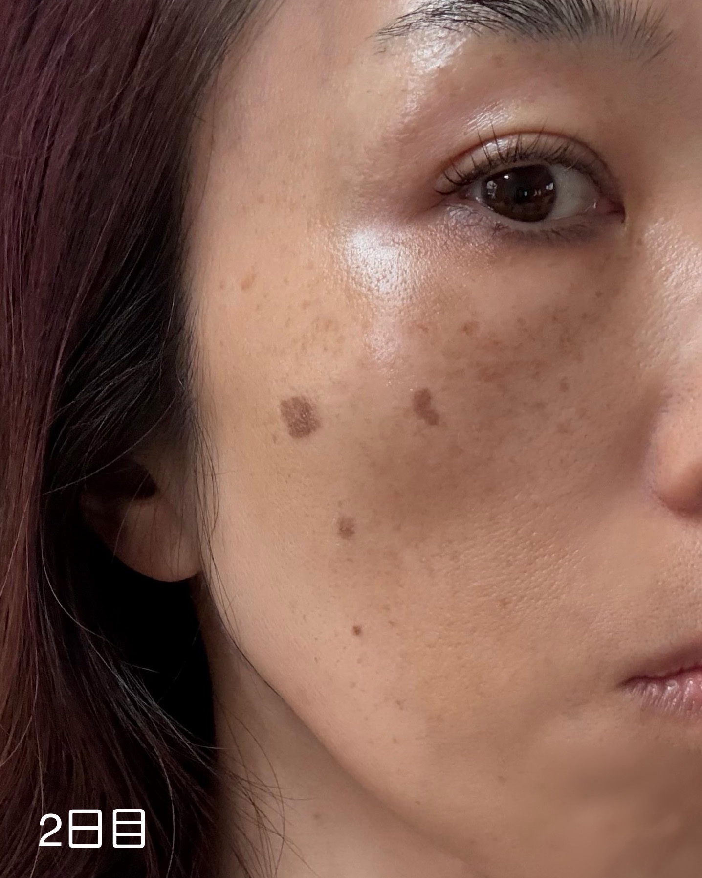 モイスチュア ローション/カルテHD/化粧水を使ったクチコミ（3枚目）