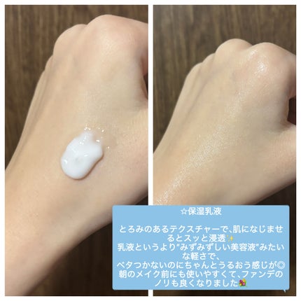 ãã«ãŒããŒã³B5-PDRNâ¢ãã€ã«ãããŒã·ã§ã³/BRING GREEN/乳液ã䜿ã£ãã¯ãã³ãïŒ2æç®ïŒ