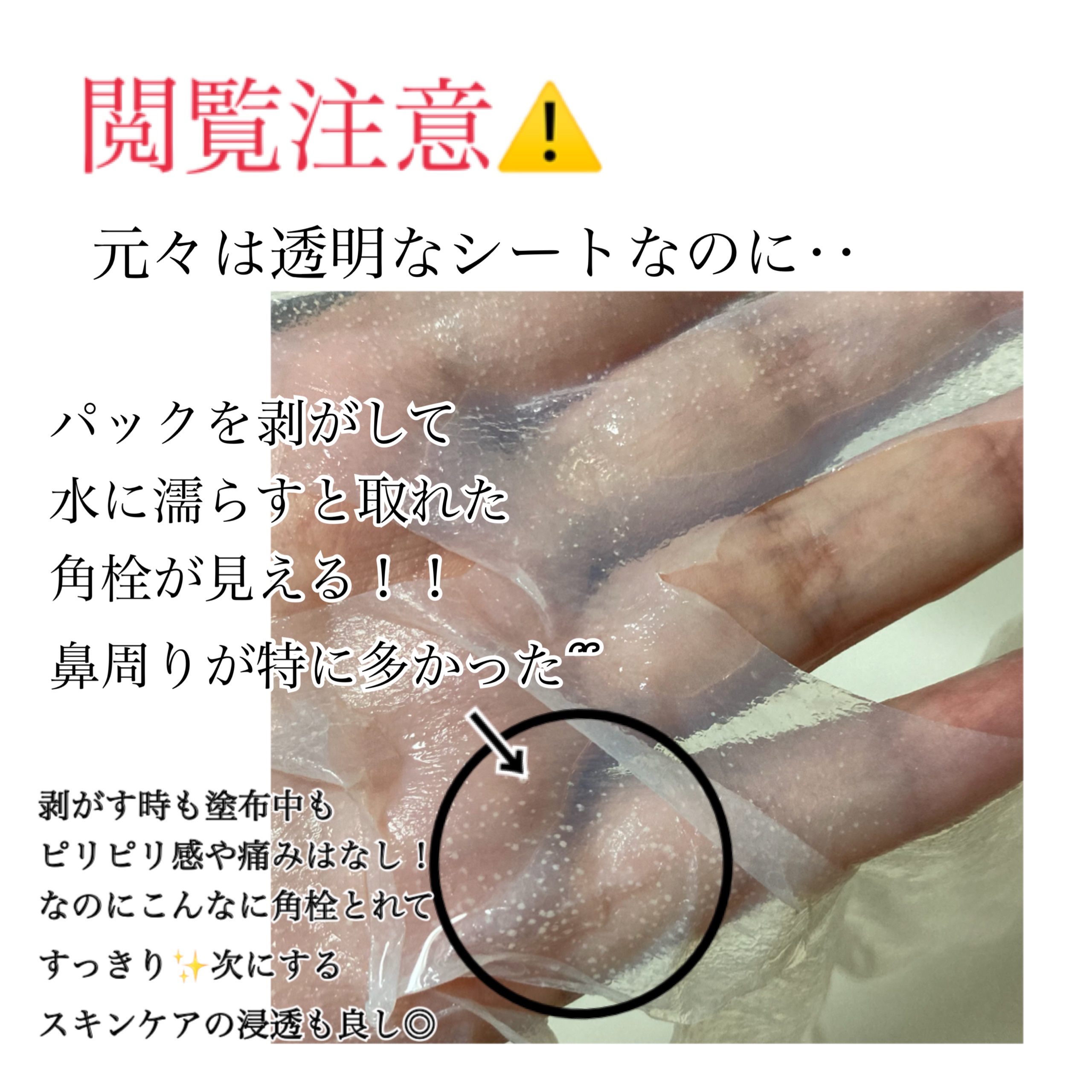 トラブルパッチマスク/EIOM/その他スキンケアを使ったクチコミ（3枚目）