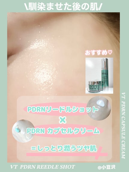 PDRN+リードルS 100/VT/美容液を使ったクチコミ(4枚目)