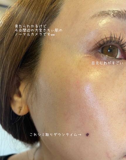 デュアル エフェクト アンプル/REJURAN COSMETICS/美容液を使ったクチコミ(2枚目)