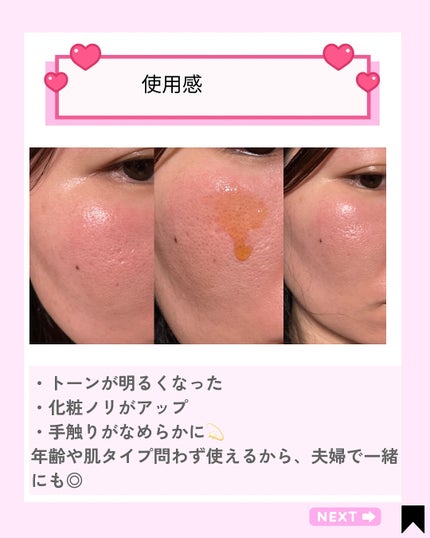 Kana on LIPS 「\40年のロングセラーが、さらに進化💛/ダブルセーラム40周年..」(4枚目)