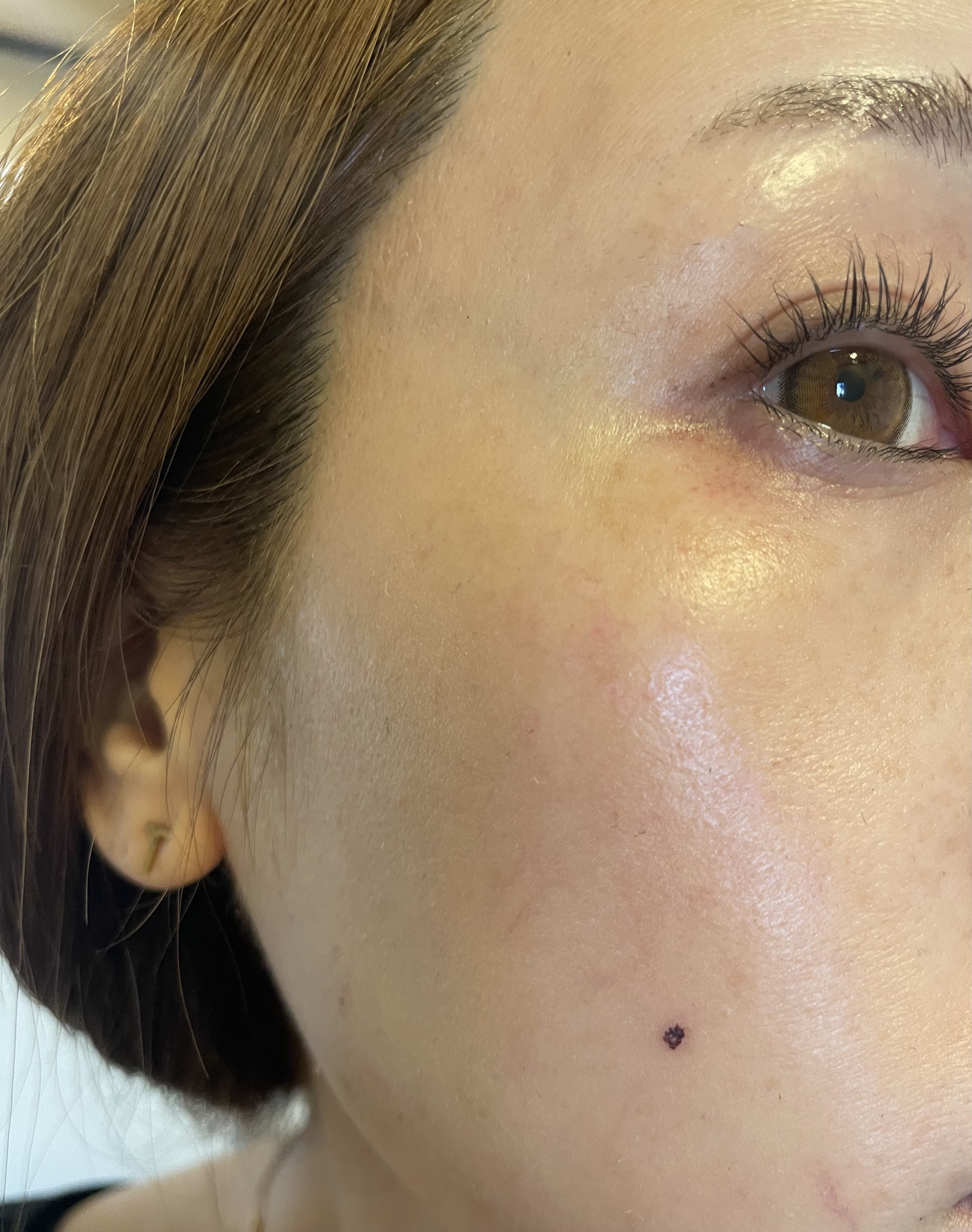 EPL キュアクリームXD/Dr.Oracle/フェイスクリームを使ったクチコミ（2枚目）