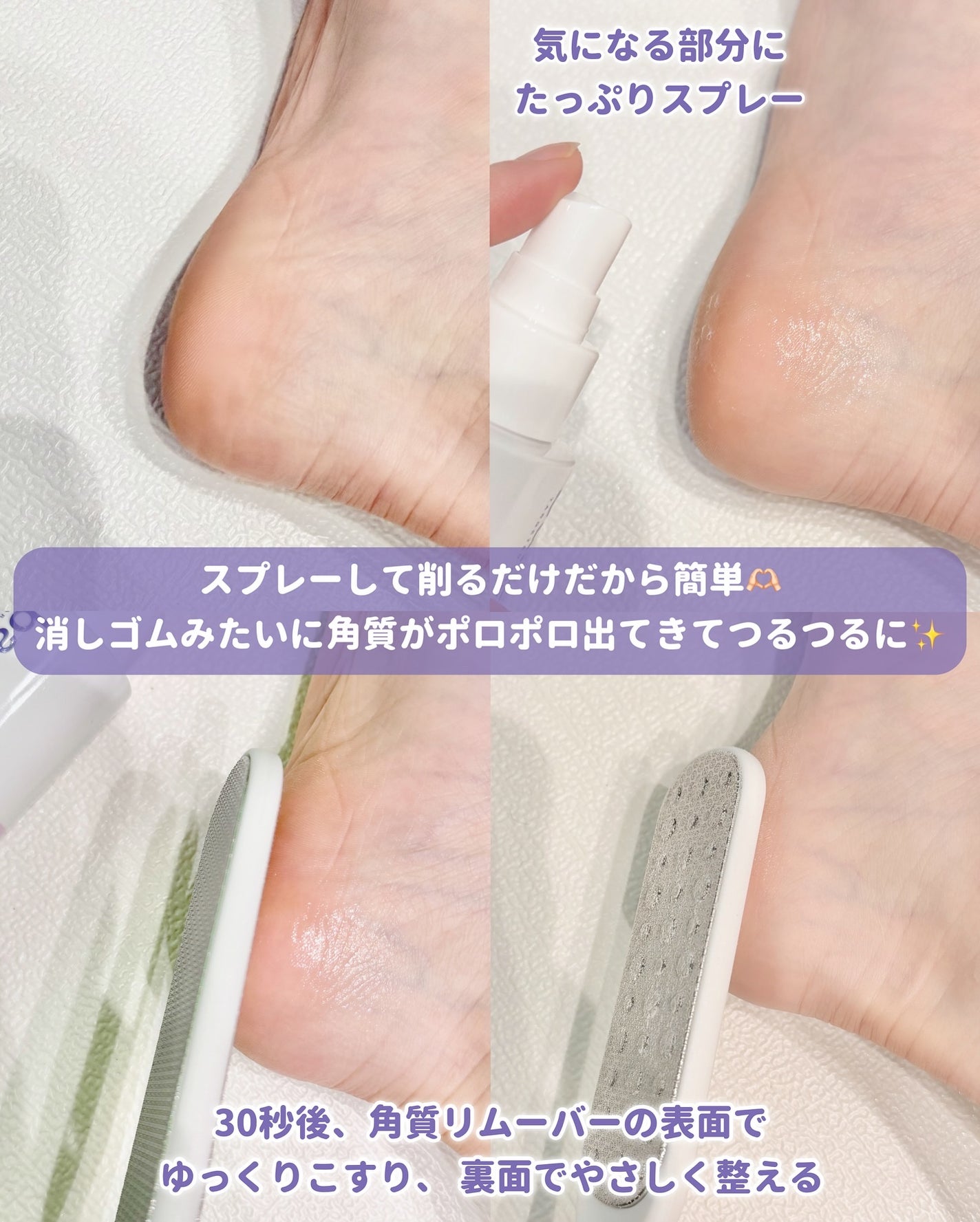 フットケアセット/BAREN/その他キットセットを使ったクチコミ(4枚目)