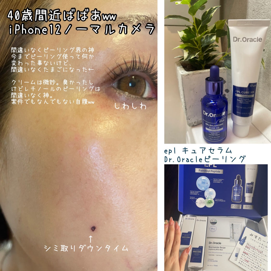 EPL キュアクリームXD/Dr.Oracle/フェイスクリームを使ったクチコミ（1枚目）