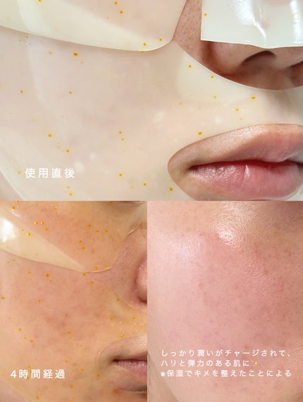 ReDRN スキンマグネットマスク/Dr.nineteen/シートマスク・パックを使ったクチコミ(4枚目)