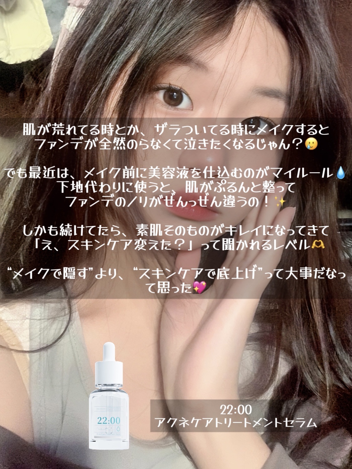 アネトス アクネケア トリートメント セラム/Anetos/美容液を使ったクチコミ（3枚目）