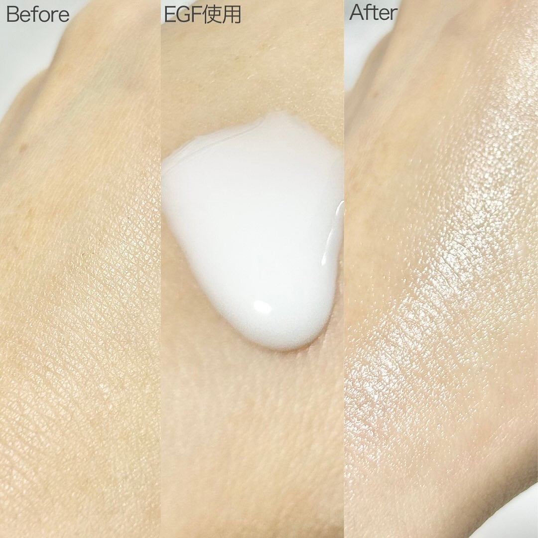 リードルSユニバースキット/VT/美容液を使ったクチコミ(9枚目)