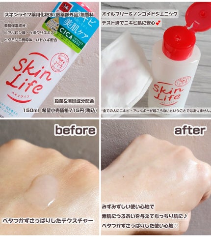 薬用化粧水/スキンライフ/化粧水を使ったクチコミ(2枚目)