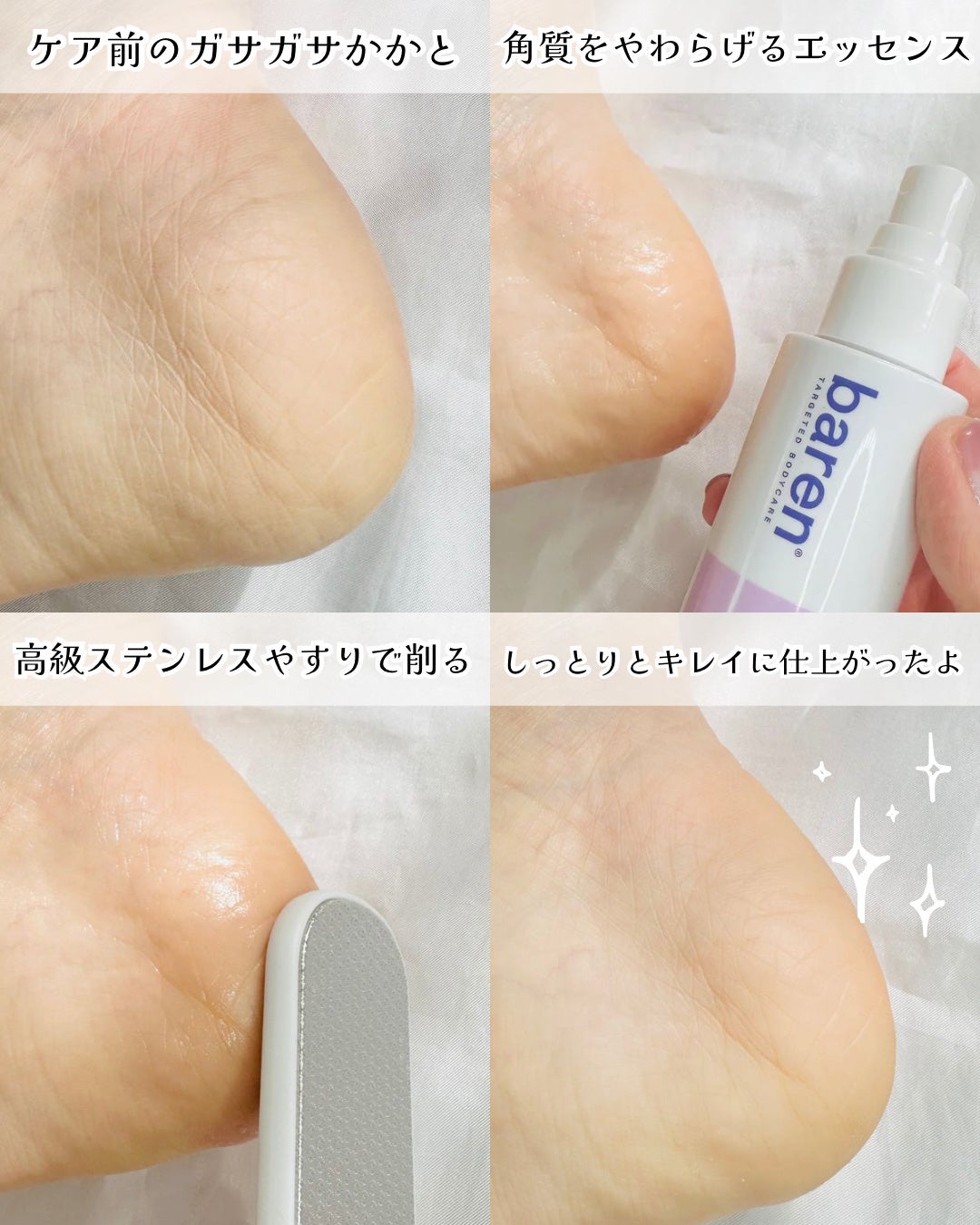 フットケアセット/BAREN/その他キットセットを使ったクチコミ(2枚目)