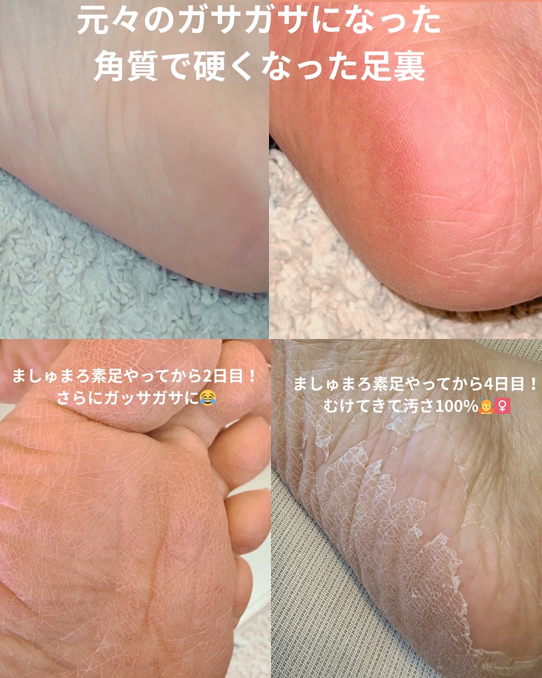 ましゅまろ素足/ピコモンテ/レッグ・フットケアを使ったクチコミ（3枚目）