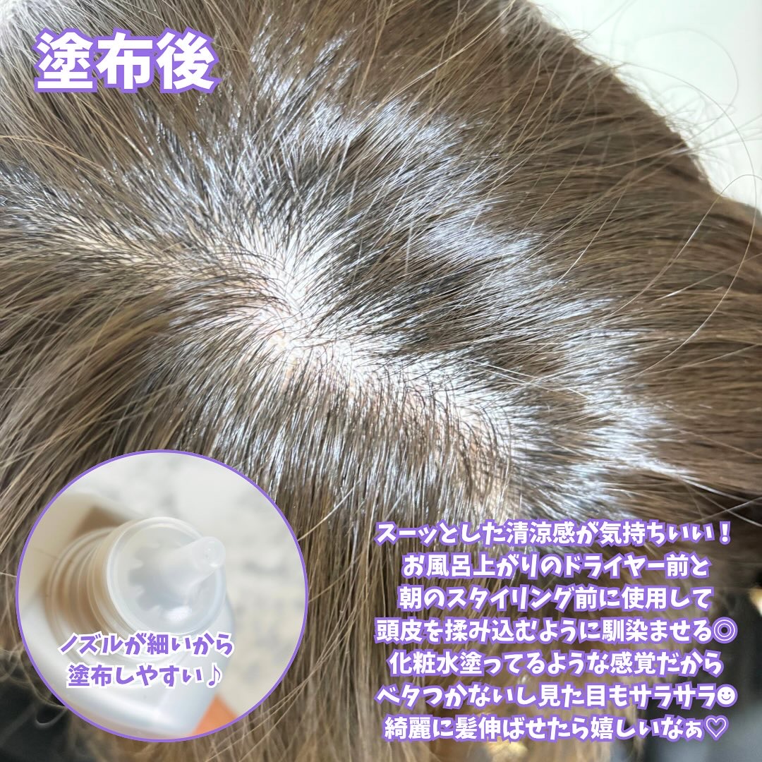 ヘアアクセルレーターEX PRO/加美乃素本舗/頭皮ローションを使ったクチコミ（3枚目）