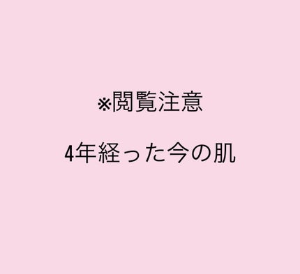 マキロン アクネージュ メディカルクリーム (医薬品) /マキロン/その他を使ったクチコミ(1枚目)
