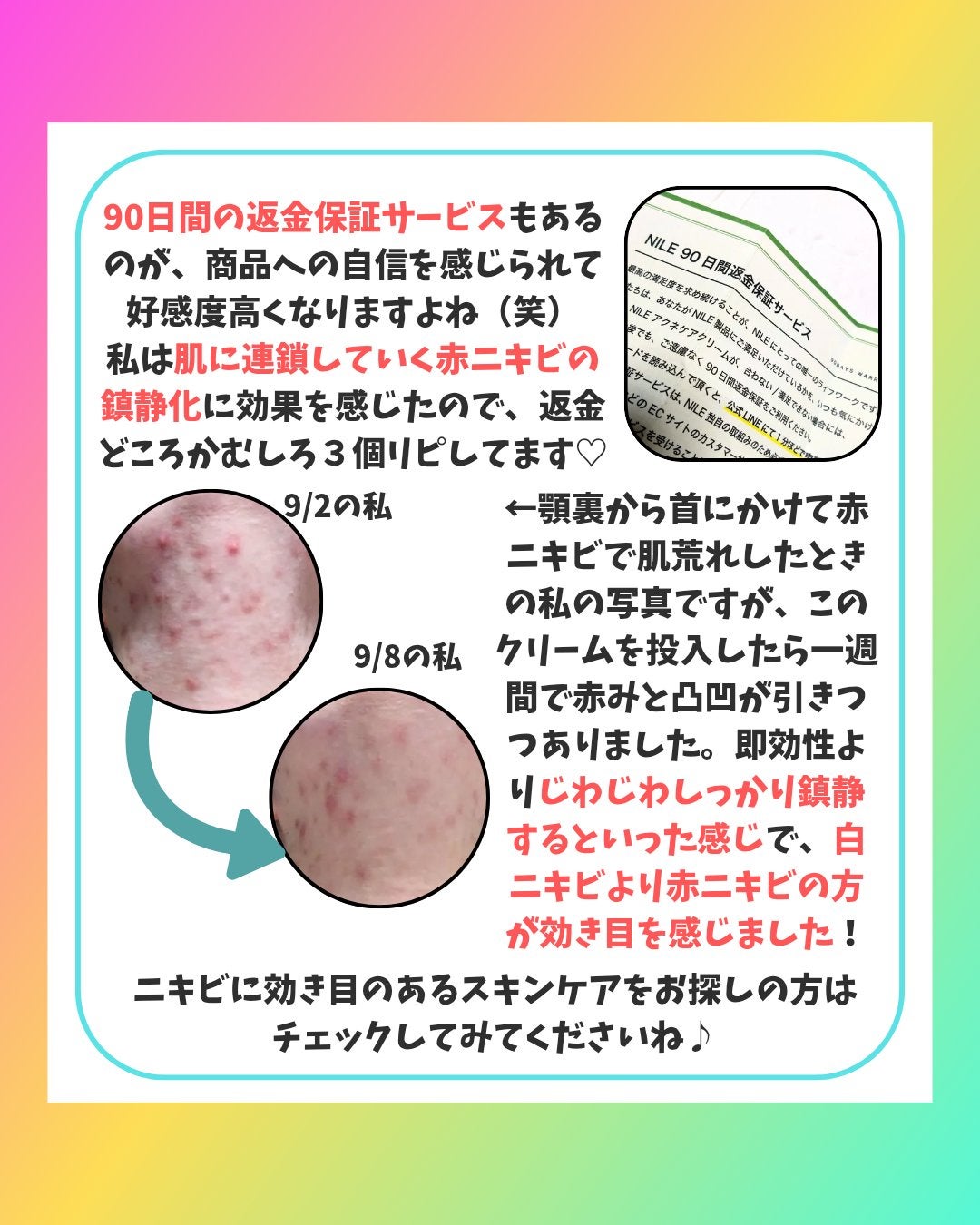 NILEアクネケアクリーム/NILE/フェイスクリームを使ったクチコミ(4枚目)