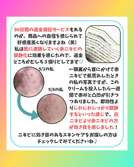 NILEアクネケアクリーム/NILE/フェイスクリームを使ったクチコミ(4枚目)