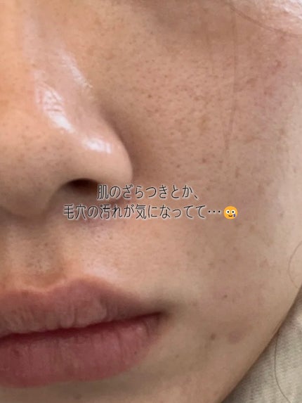 アネトス マイルド フェイシャル クレンザー/Anetos/洗顔フォームを使ったクチコミ(2枚目)