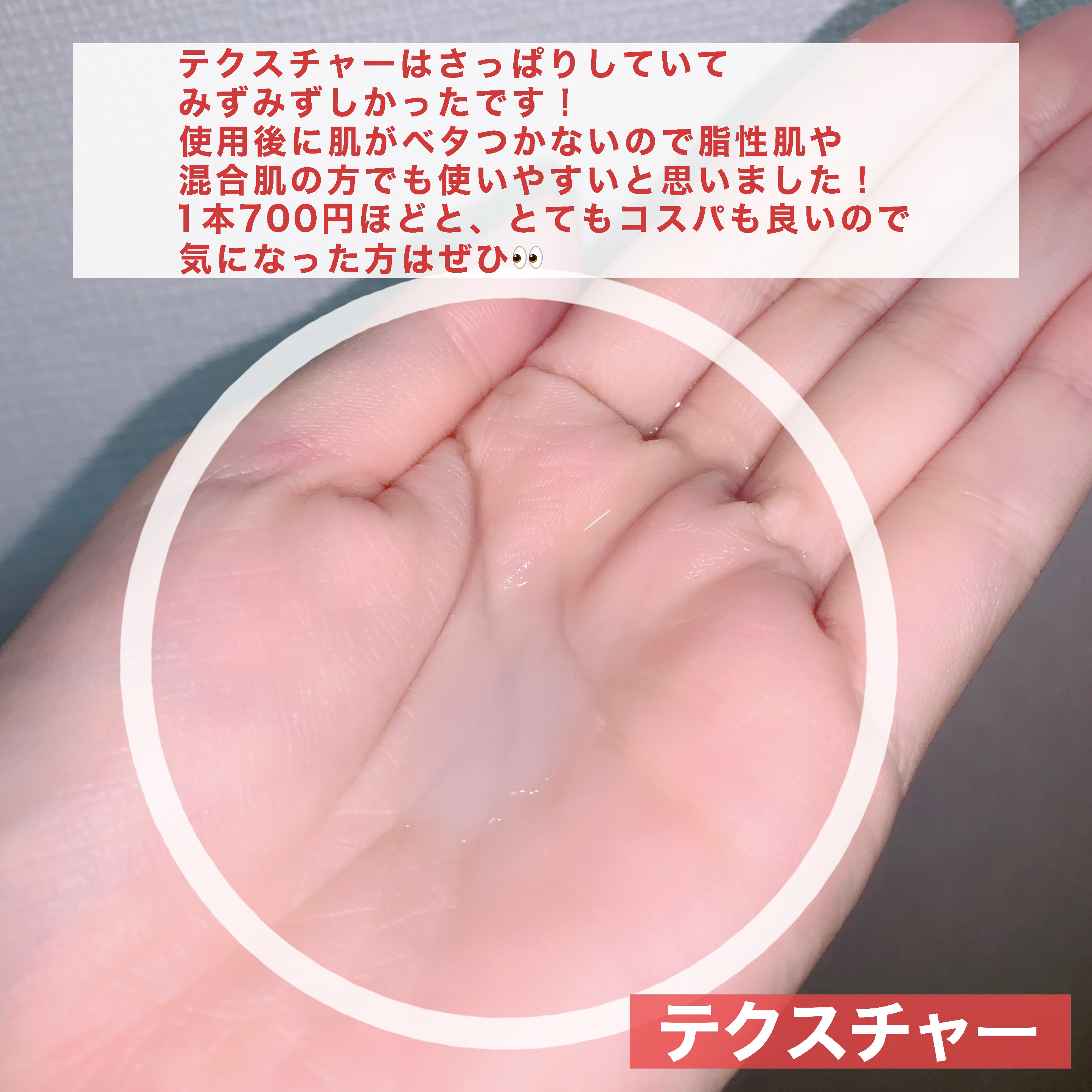 薬用化粧水/スキンライフ/化粧水を使ったクチコミ（3枚目）