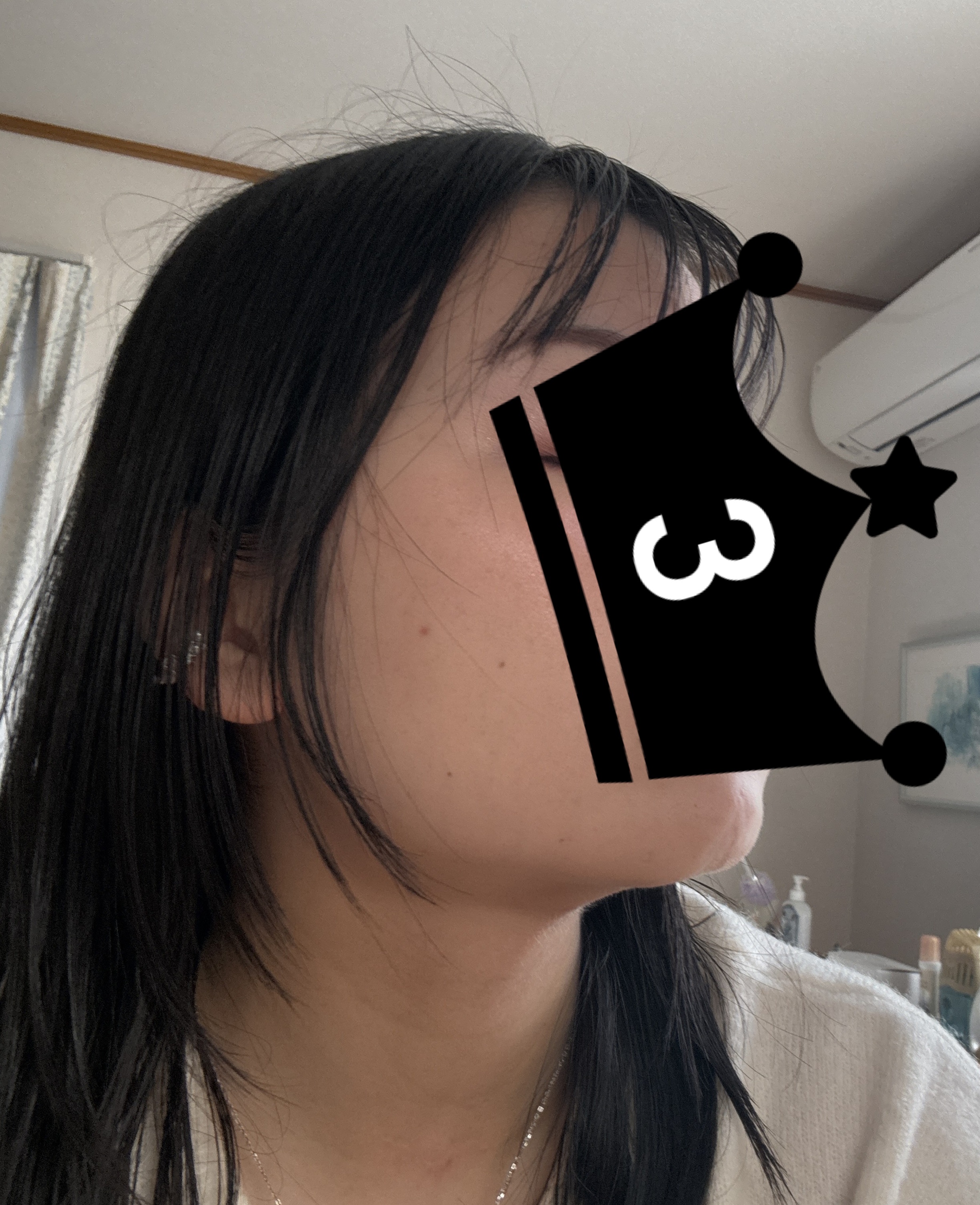 VC100エマルジョンEX/ドクターシーラボⓇ/乳液を使ったクチコミ（2枚目）