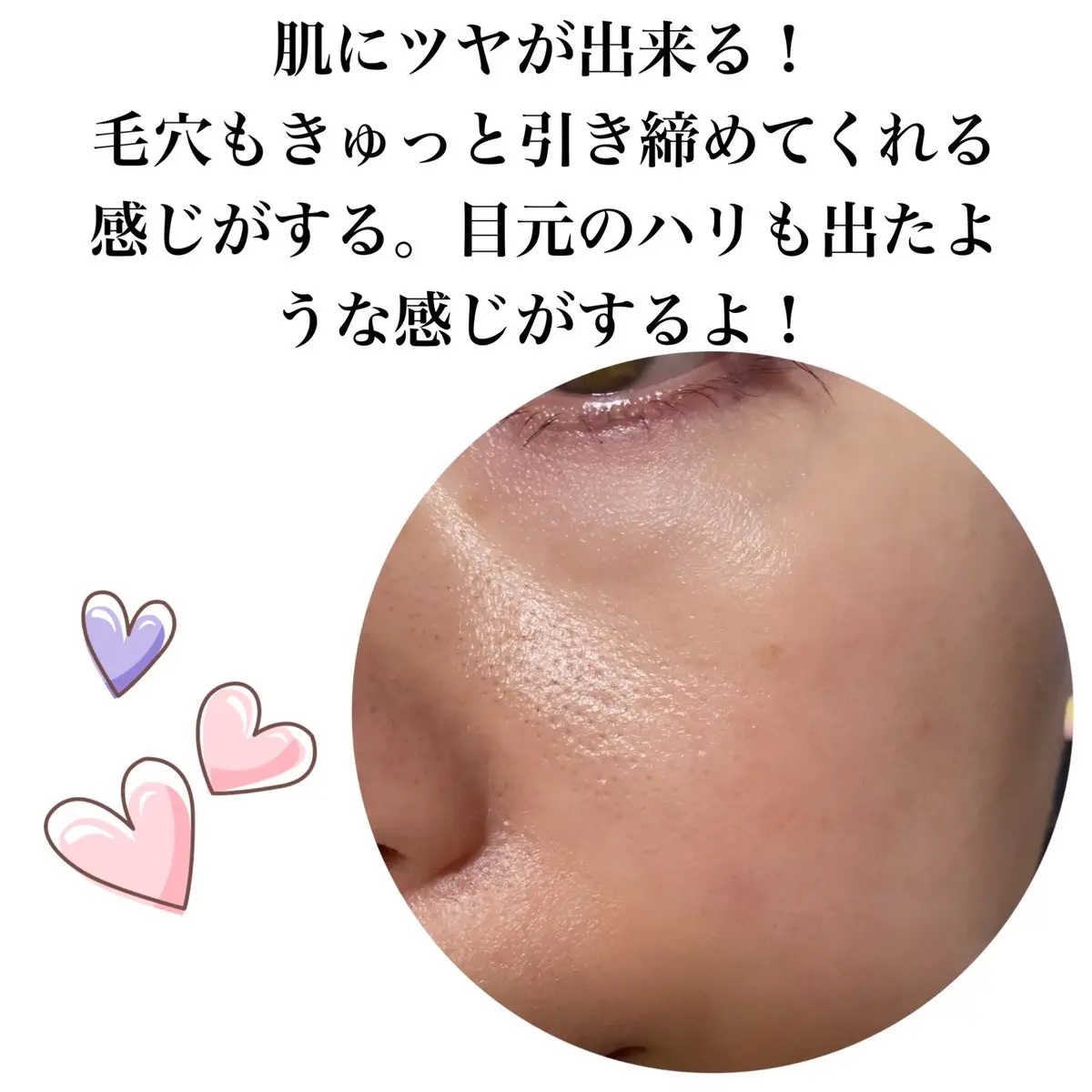 スピテラパーミアPDRNアンプル/NUDIQUE/美容液を使ったクチコミ（3枚目）