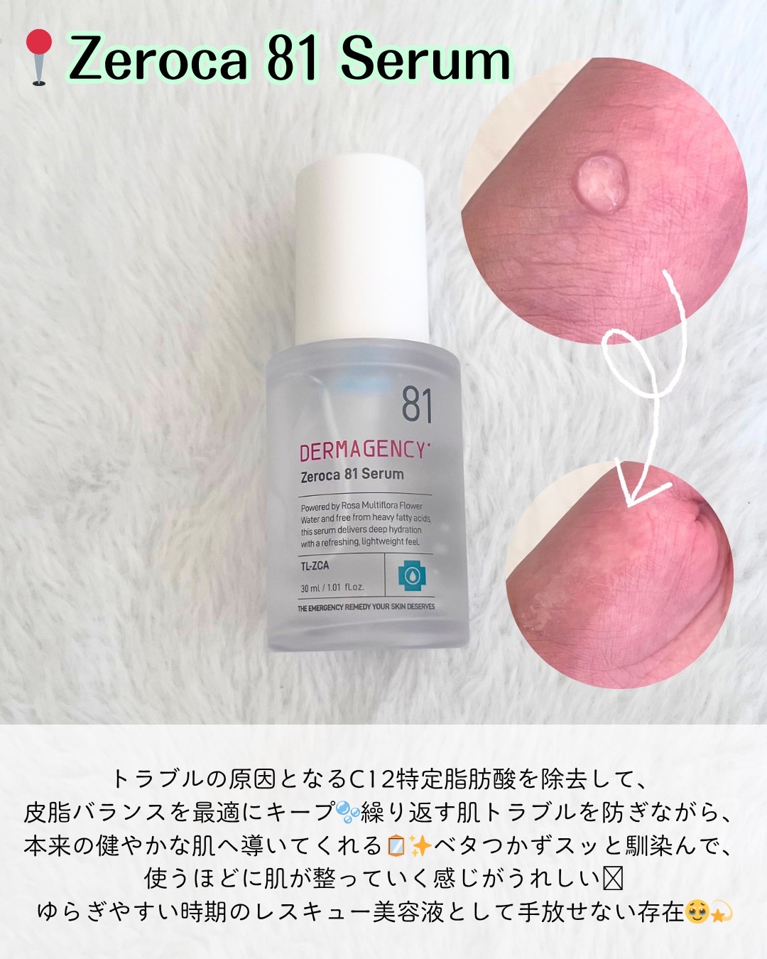 ダーマジェンシー ゼロカ86 トナー/DERMAGENCY/化粧水を使ったクチコミ（3枚目）