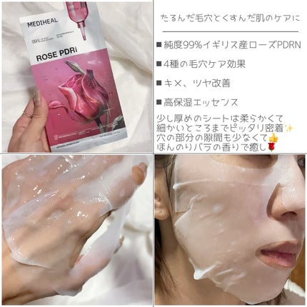 ローゼPDRNエッセンシャルマスクヘルシーグロウ/MEDIHEAL/シートマスク・パックを使ったクチコミ(2枚目)