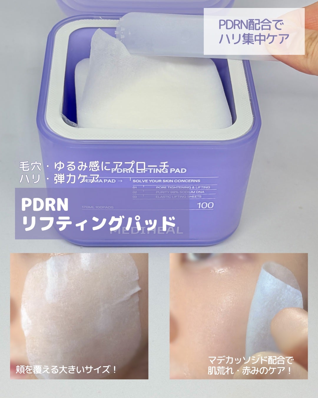 マデカソサイド ブレミッシュパッド/MEDIHEAL/トナーパッドを使ったクチコミ(3枚目)