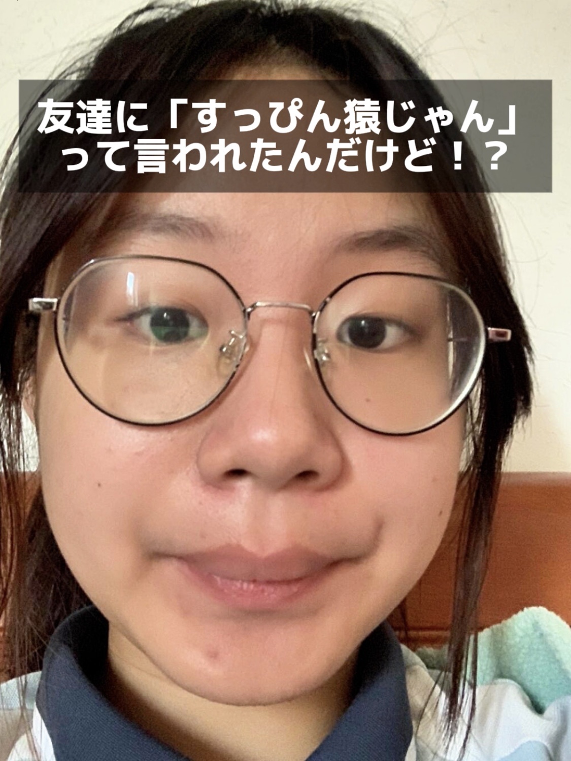 アネトス アクネケア トリートメント セラム/Anetos/美容液を使ったクチコミ（1枚目）