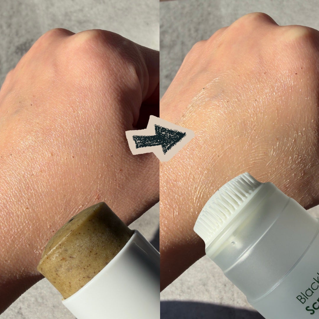 ブラックヘッドバームスクラブ/オブジェ/フェイスバームを使ったクチコミ(3枚目)