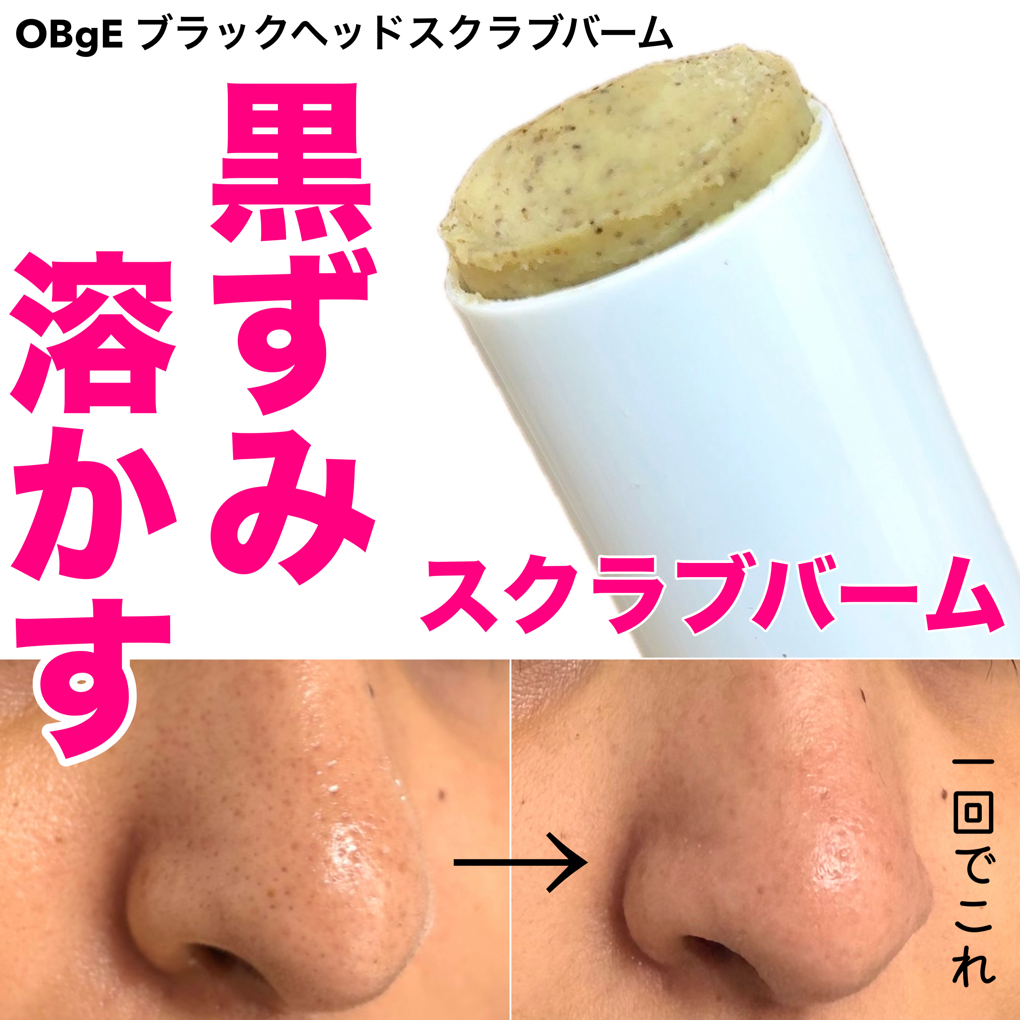 ブラックヘッドバームスクラブ/オブジェ/フェイスバームを使ったクチコミ（1枚目）