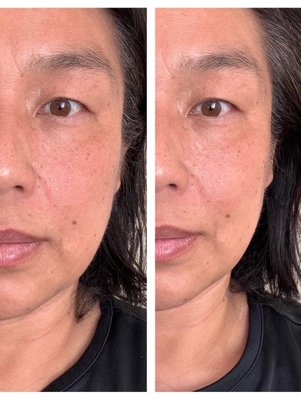 アロマナッツスリムフィットボディカッサセラム/nutseline/美容液を使ったクチコミ(7枚目)