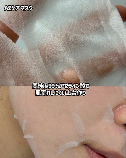 AZケア マスク/VT/シートマスク・パックを使ったクチコミ(3枚目)