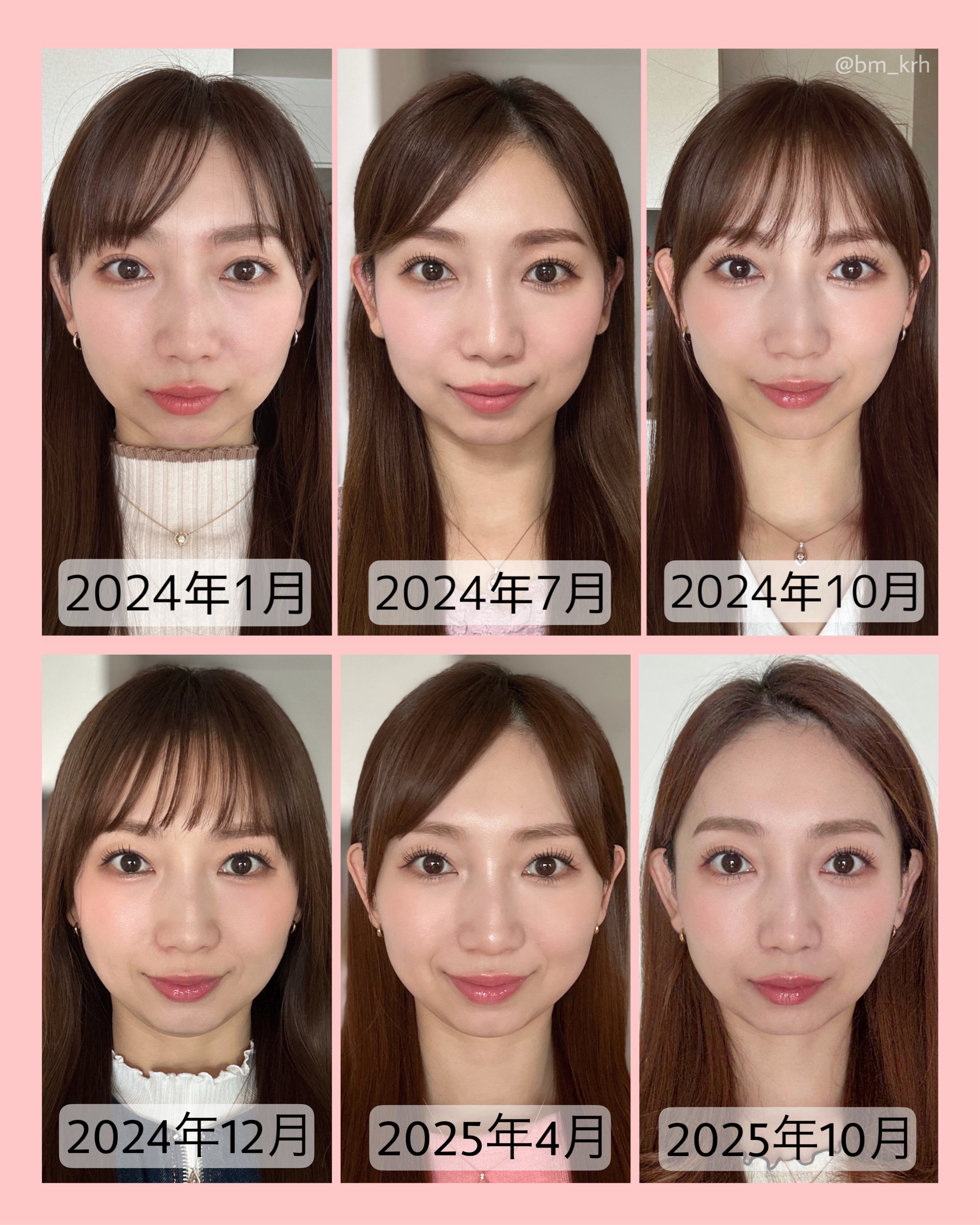 COREFIT フェイスポインター/CORE FIT/その他スキンケアグッズを使ったクチコミ（2枚目）