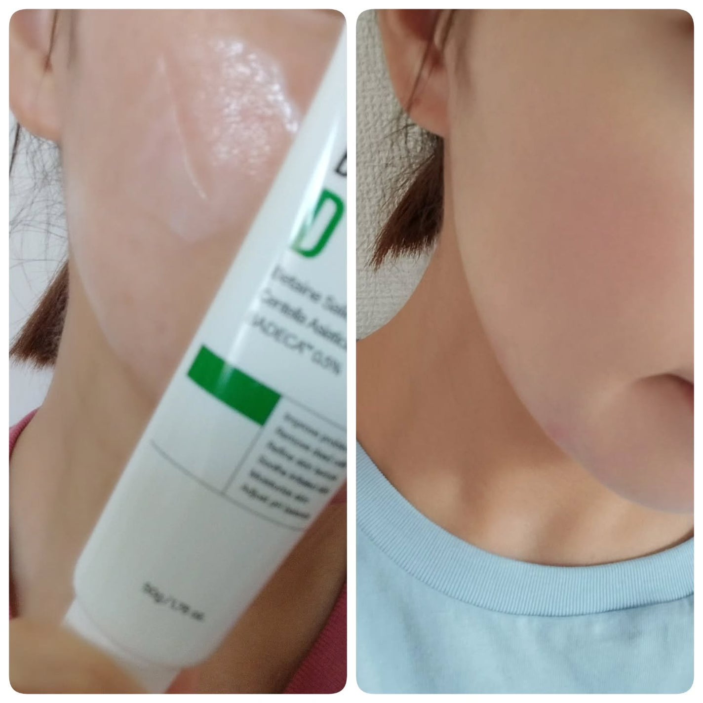 バデカシルPクリーム/23years old/フェイスクリームを使ったクチコミ(10枚目)