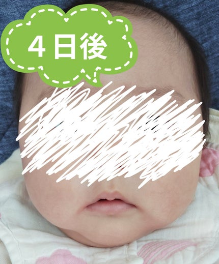 モイスチャライジング クリーム/セタフィル/ボディクリームを使ったクチコミ(3枚目)