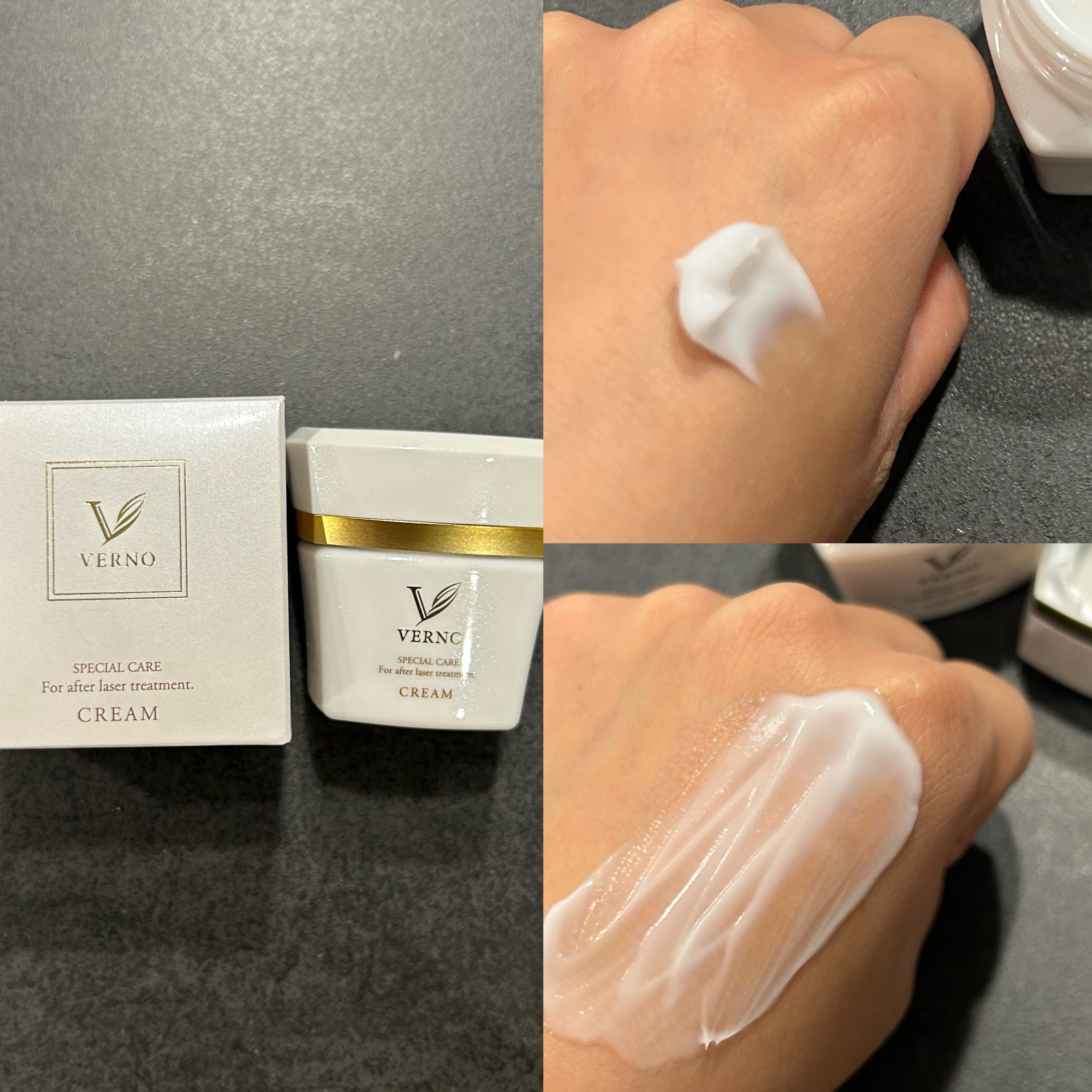VERNO SKIN ローション〈医薬部外品〉/VERNO SKIN CARE/化粧水を使ったクチコミ（3枚目）