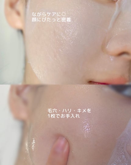 PDRN リフティングマスク/MEDIHEAL/シートマスク・パックを使ったクチコミ(3枚目)