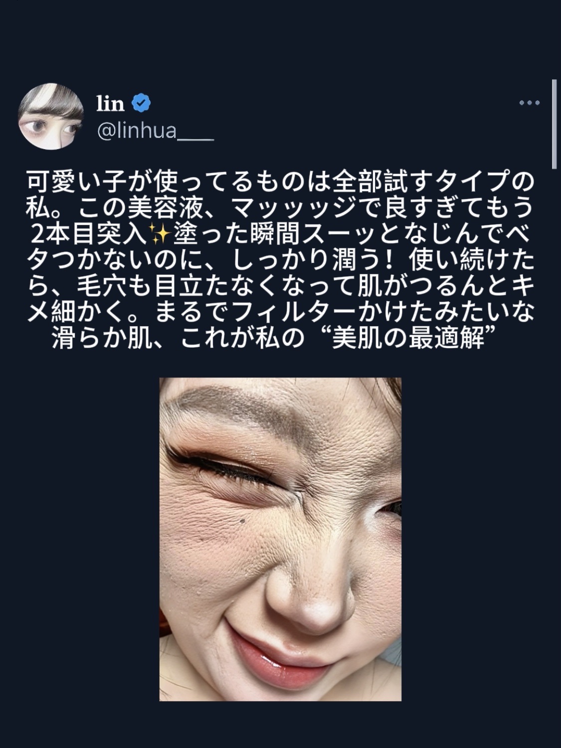 アネトス アクネケア トリートメント セラム/Anetos/美容液を使ったクチコミ（1枚目）