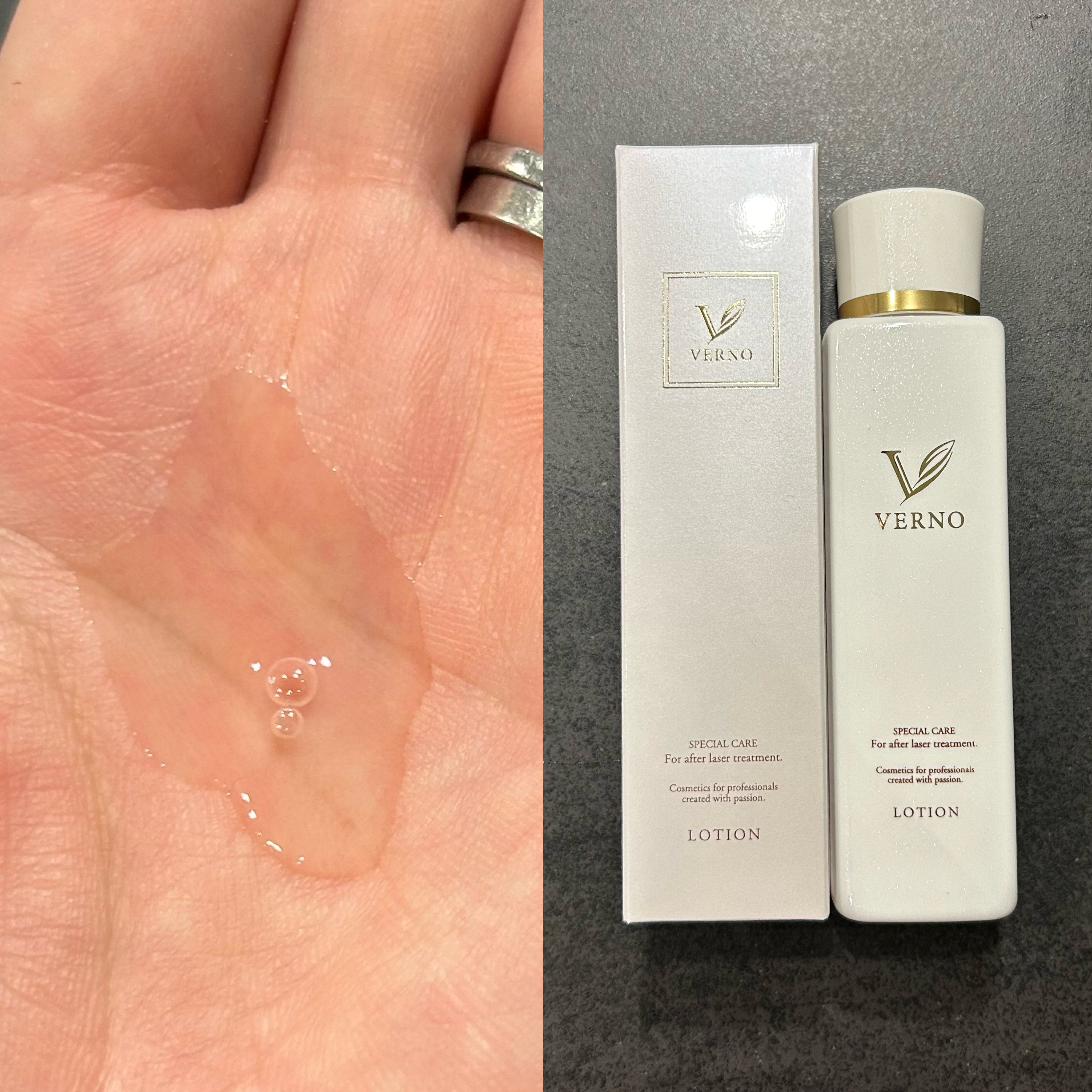 VERNO SKIN ローション〈医薬部外品〉/VERNO SKIN CARE/化粧水を使ったクチコミ（2枚目）