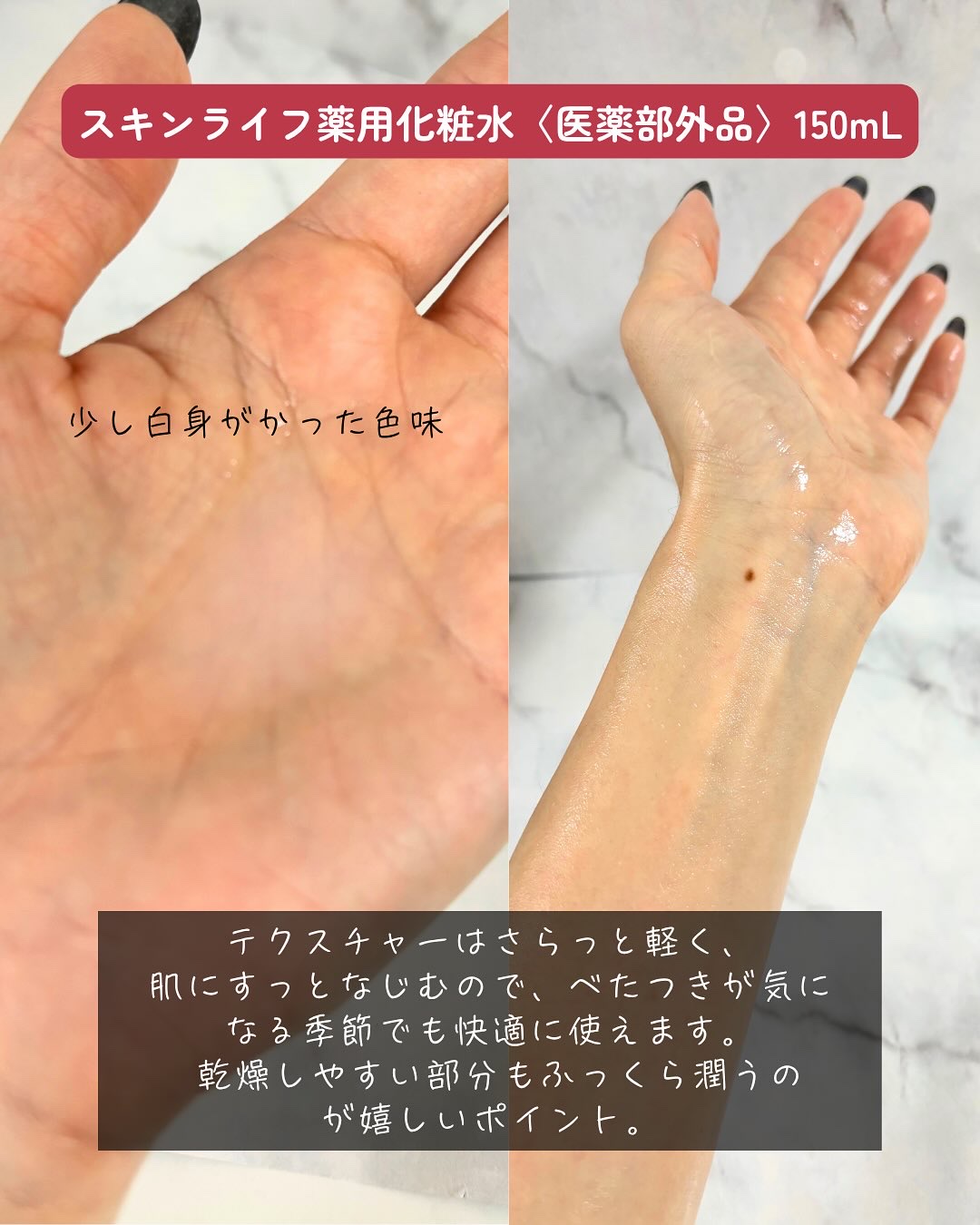 薬用化粧水/スキンライフ/化粧水を使ったクチコミ（3枚目）