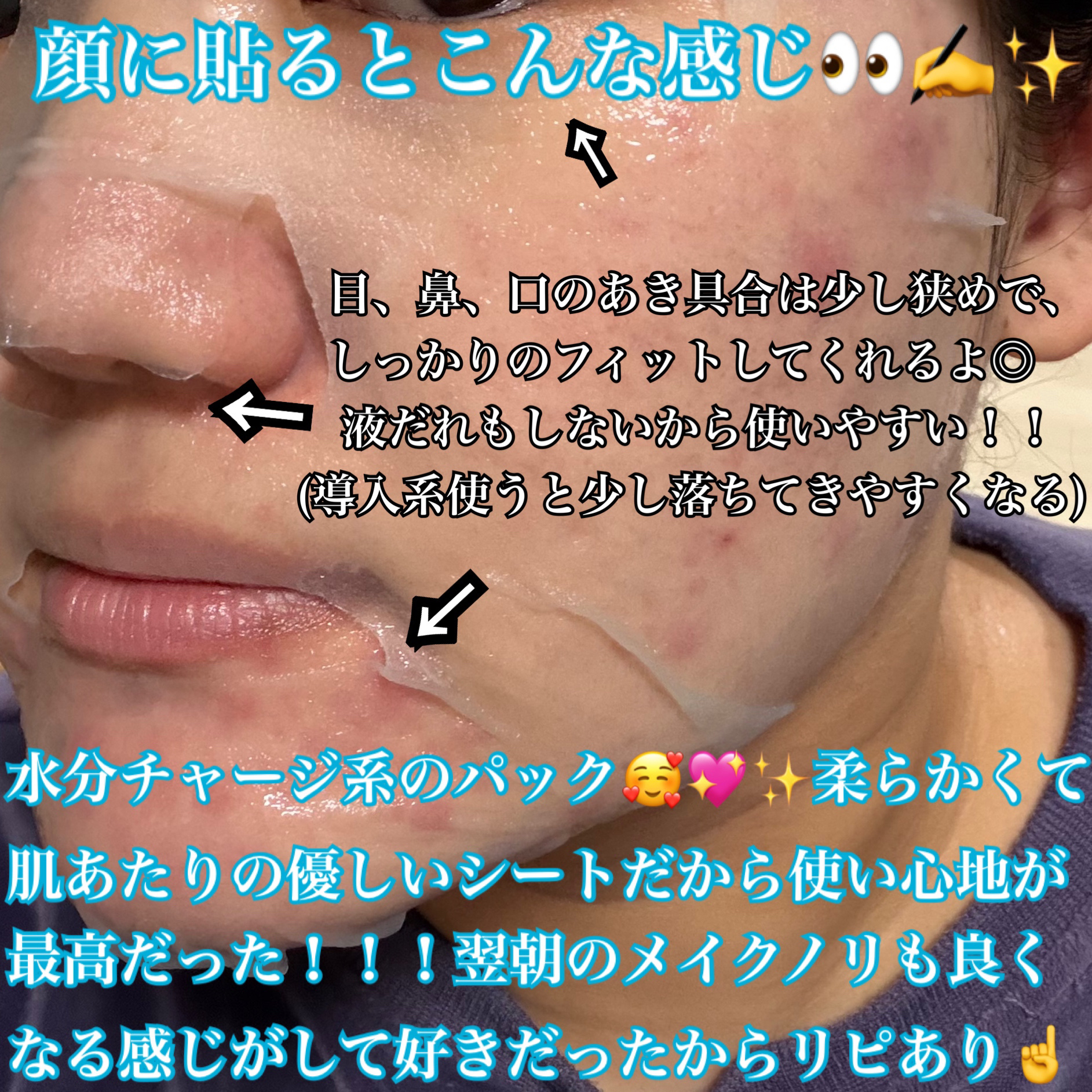 PDRNヒアルロン酸カプセル100セラムマスクパック/Anua/シートマスク・パックを使ったクチコミ（3枚目）