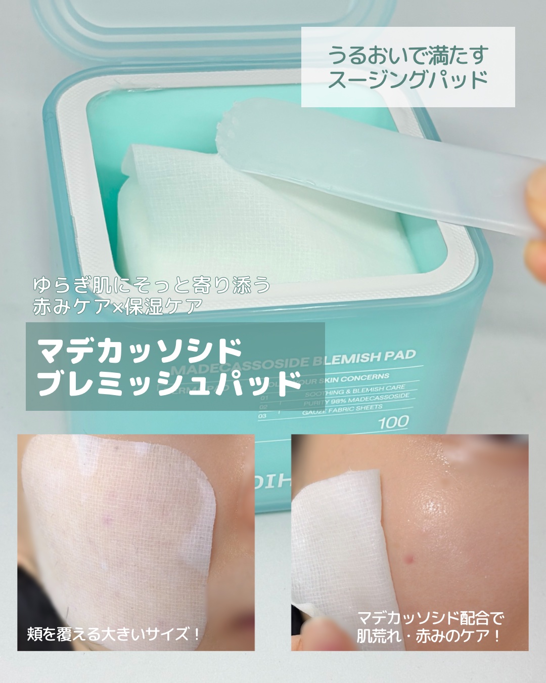 マデカソサイド ブレミッシュパッド/MEDIHEAL/トナーパッドを使ったクチコミ（2枚目）