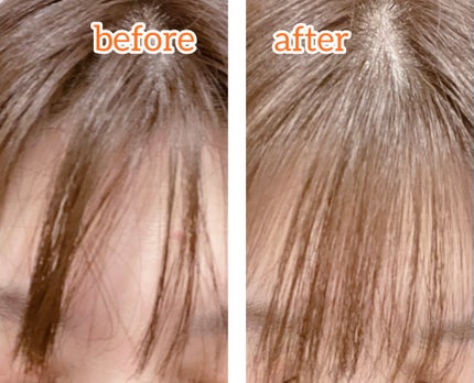 ヴィーガンドライシャンプーアンプル/ureun/ドライシャンプーを使ったクチコミ(4枚目)