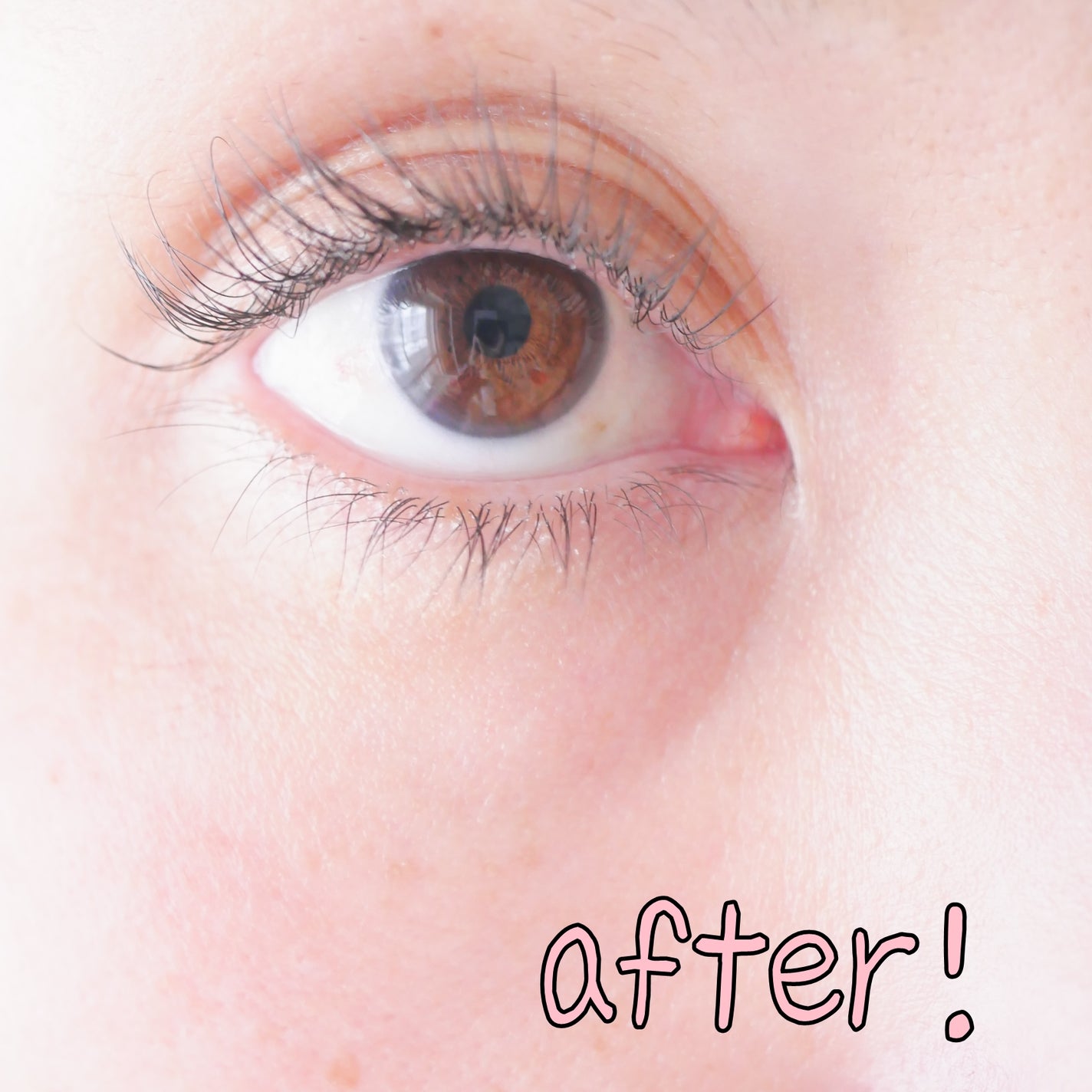 デュアル エフェクト アンプル/REJURAN COSMETICS/美容液を使ったクチコミ(10枚目)