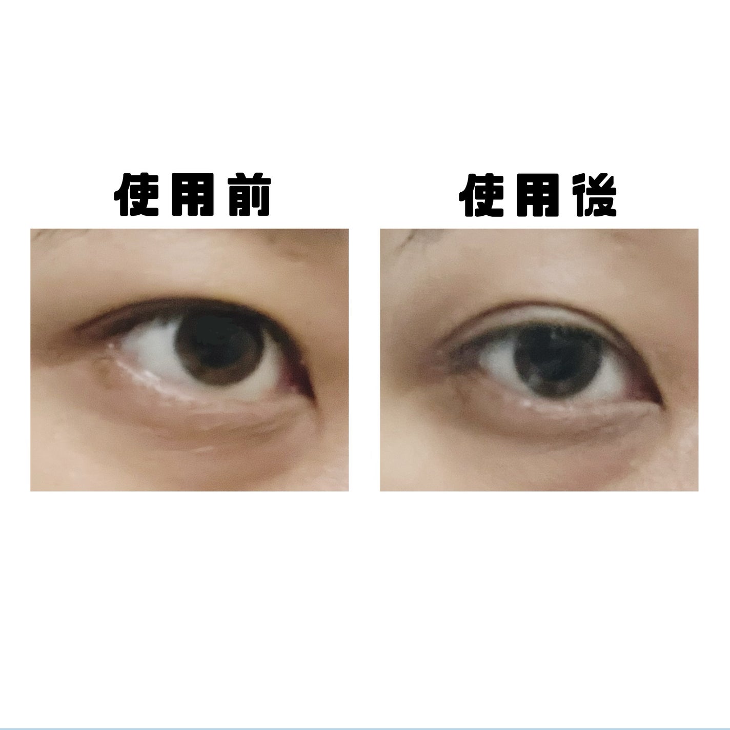 ルドゥーブルオム/ルドゥーブル/二重まぶた用アイテムを使ったクチコミ(2枚目)