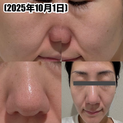 ダーマエイド トリプルアクティブエッセンス【医薬部外品】/pdc/美容液を使ったクチコミ(3枚目)