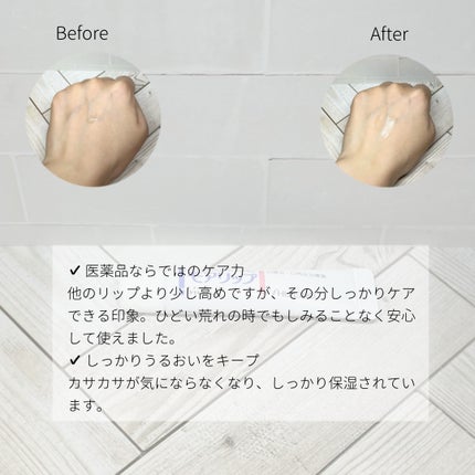 モアリップ N (医薬品)/資生堂薬品/その他を使ったクチコミ(2枚目)