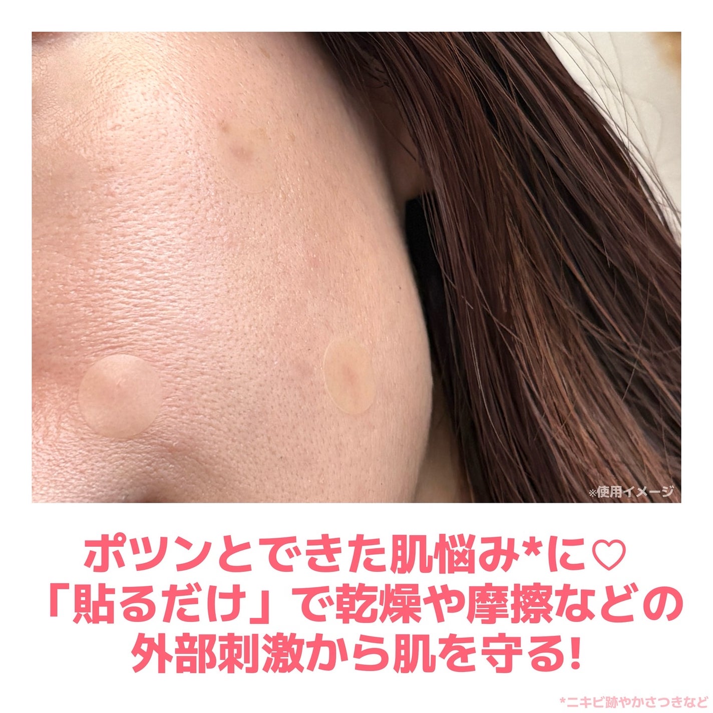 バンドエイド 顔用パッチ/ジョンソン・エンド・ジョンソン/にきびパッチを使ったクチコミ(5枚目)