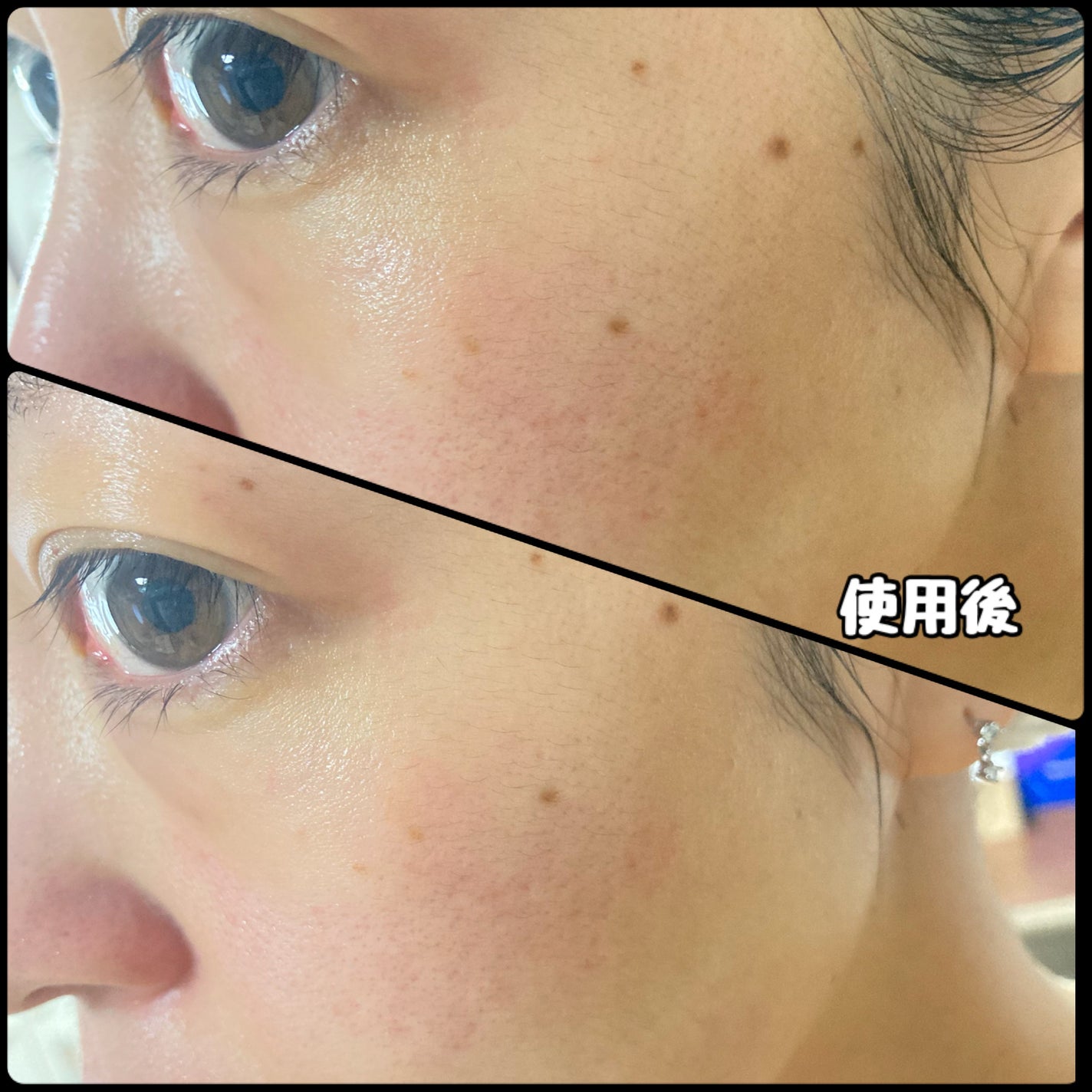 スピテラパーミアPDRNアンプル/NUDIQUE/美容液を使ったクチコミ(4枚目)