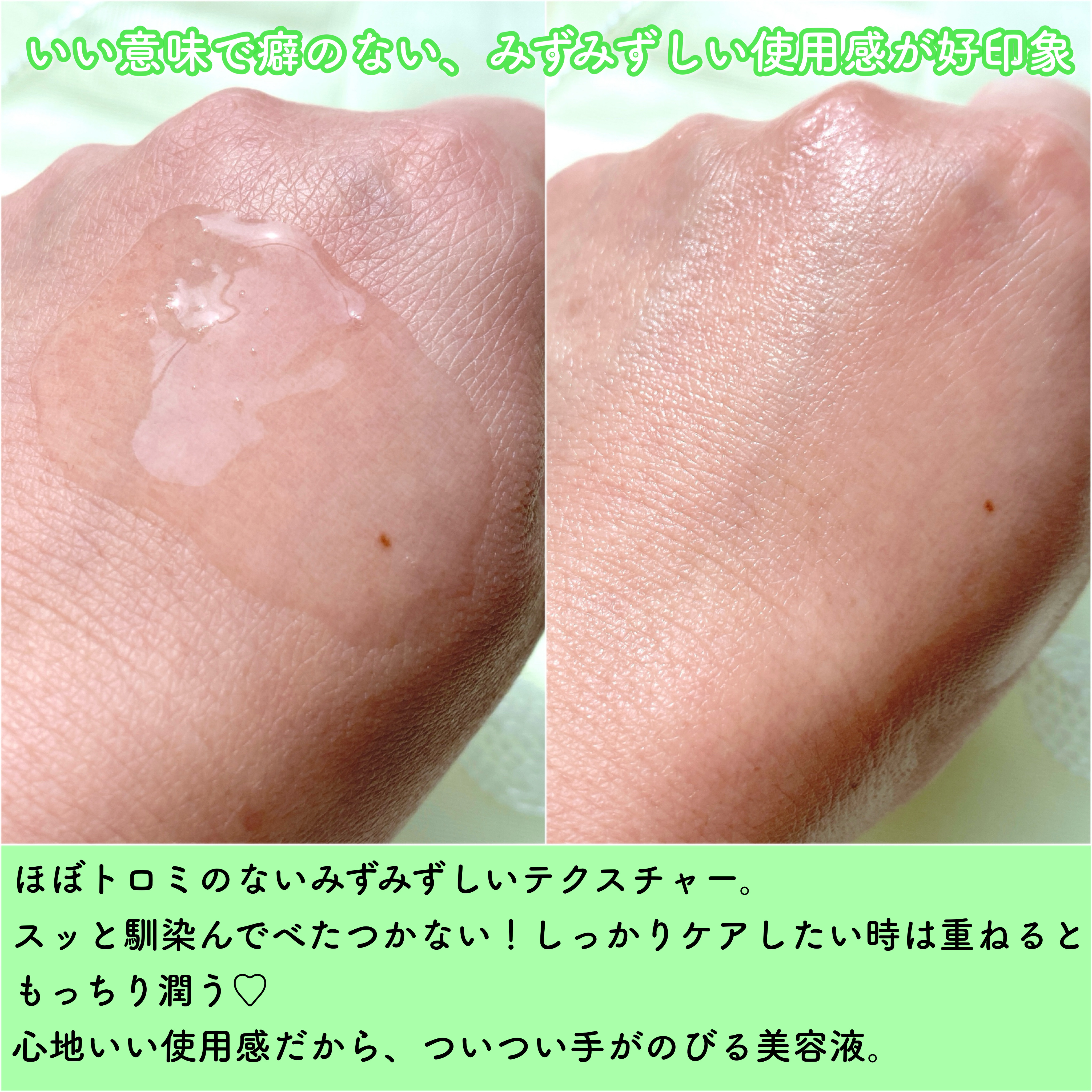 ノスカナイントラブルセラムS/FATION/美容液を使ったクチコミ（3枚目）